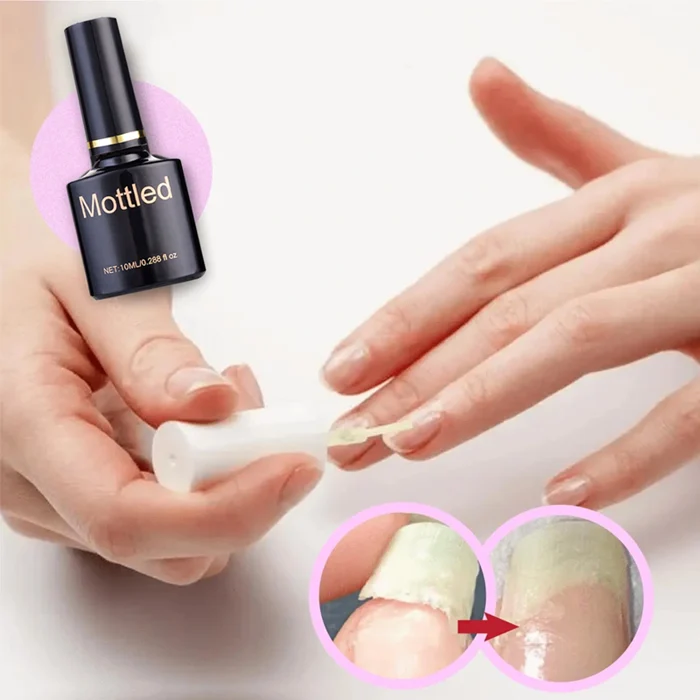 1+1 Gratis | Nagelreparatur Schutzgel™