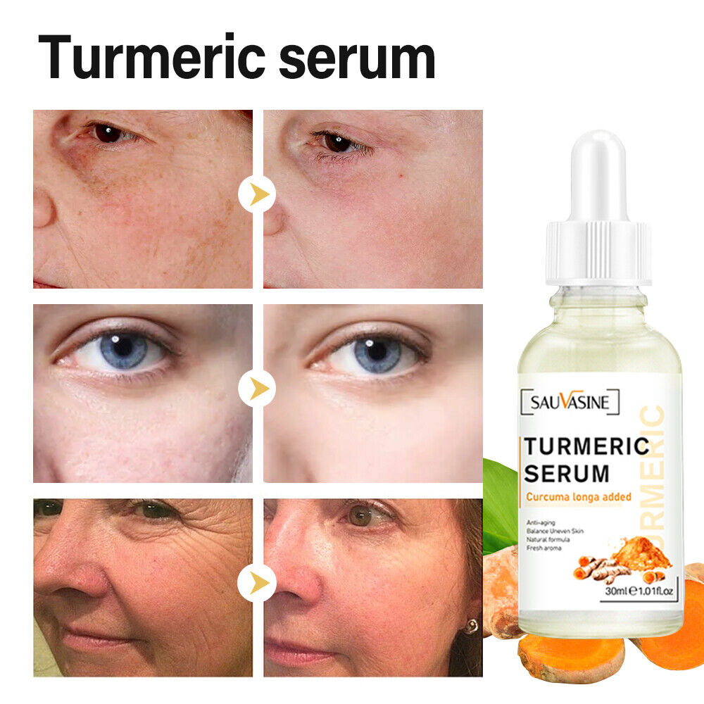 1+1 Gratis | TumericGlow™ Kurkuma Anti-Oxidations-Serum