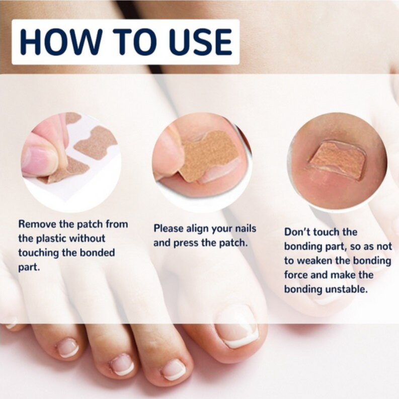 1+1 Gratis | Klebefreies Zehennagelpflaster™ Reparieren Sie beschädigte Nägel
