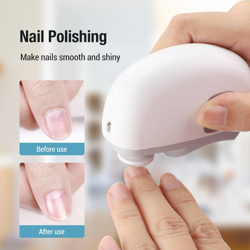 NailEase™ – Elektrischer Nagelknipser