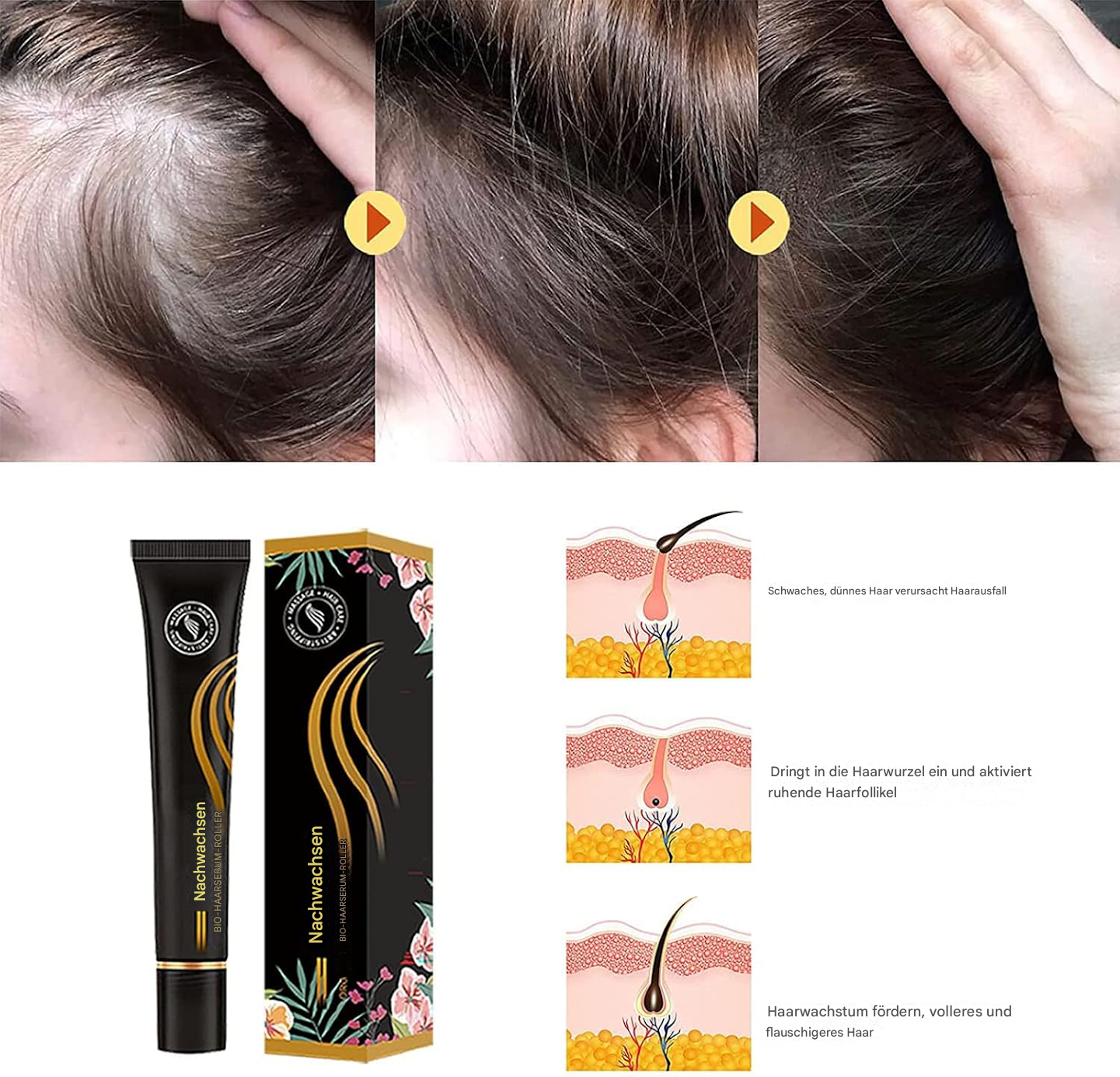 1+1 GRATIS | Follicyn™ Bio-Haarserum Roller