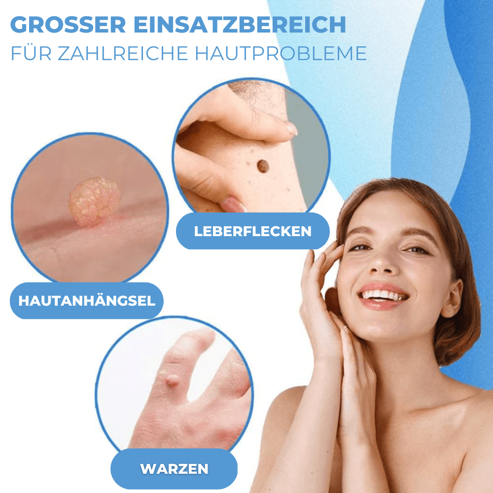 Warzen & Muttermale Entferner Set