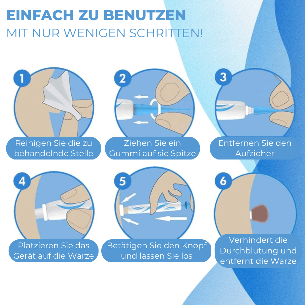 Warzen & Muttermale Entferner Set