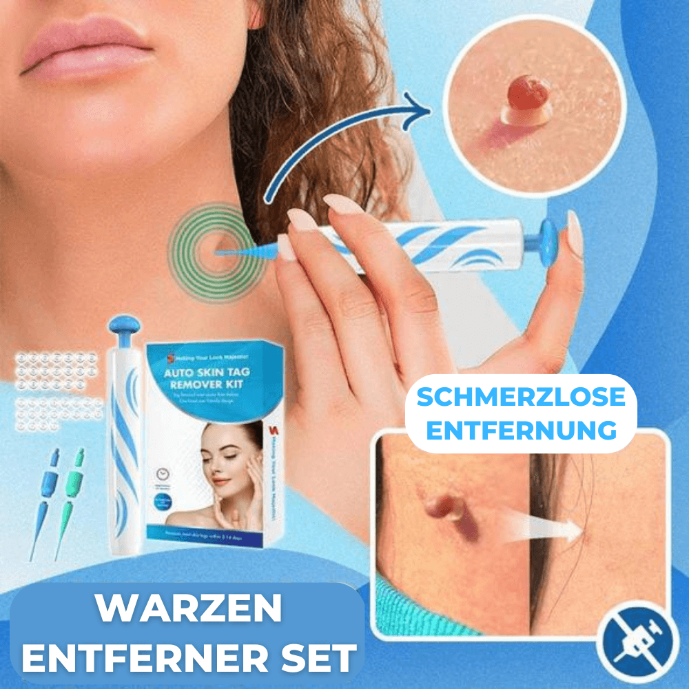 Warzen & Muttermale Entferner Set