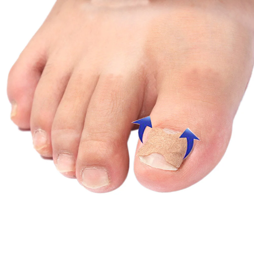 1+1 Gratis | Klebefreies Zehennagelpflaster™ Reparieren Sie beschädigte Nägel