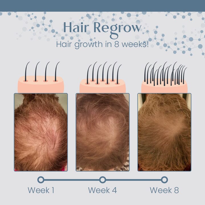 1+1 GRATIS | Ceoerty™ Root Renew Pflegendes Haarpeeling