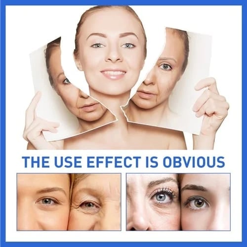 1+1 GRATIS | Hyalu™ - Botox Gesichtsserum